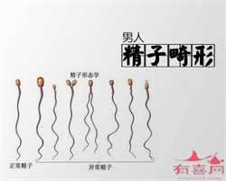 深圳国内代孕多少钱_怀孕前的讲究你知道吗？