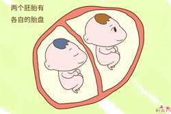 深圳助孕包成功_新生儿为什么老吐奶 4大方法预防宝宝吐奶