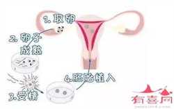 深圳专业代孕价格,深圳为何禁止商业代孕【让每一个成功案例，都是坚持代孕